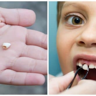 为什么父母应该拯救孩子的乳牙